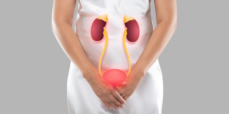 Cystitis in women is inflammation of the bladder tissue